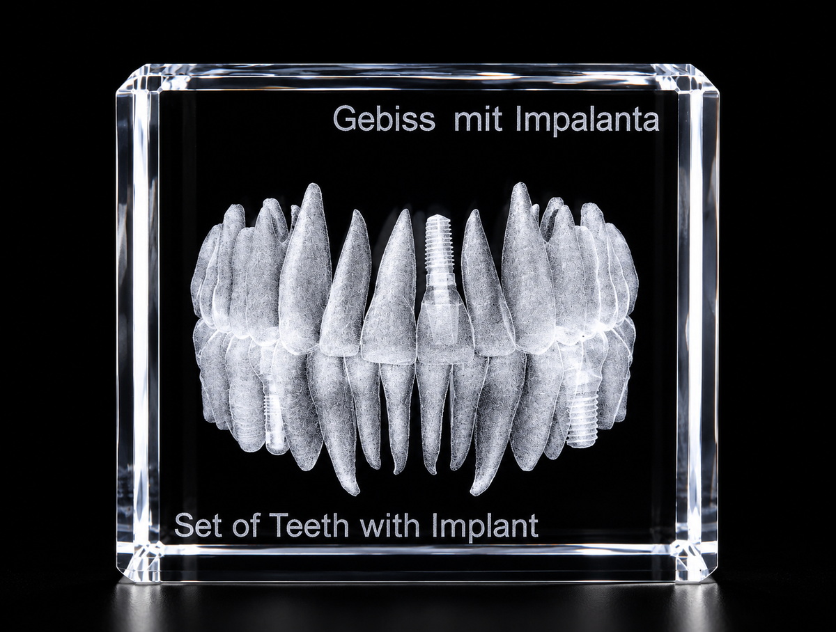 3D Gebiss mit Implantaten