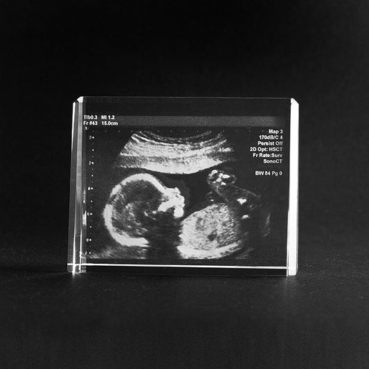 Glasfoto vom eigenen Ultraschallbild