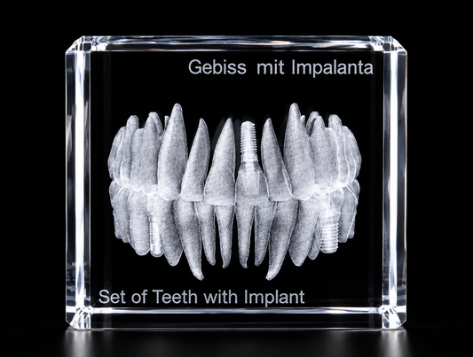 3D Gebiss mit Implantaten