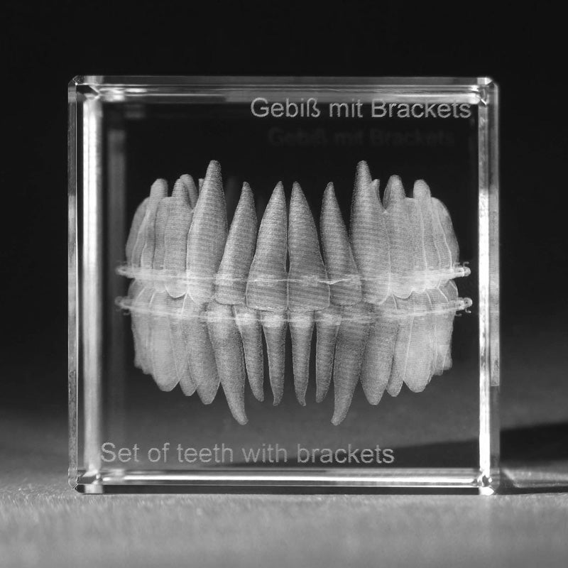 3D Zahnmodell vom menschlichen Gebiss mit Brackets, Dentalmotive in Glas