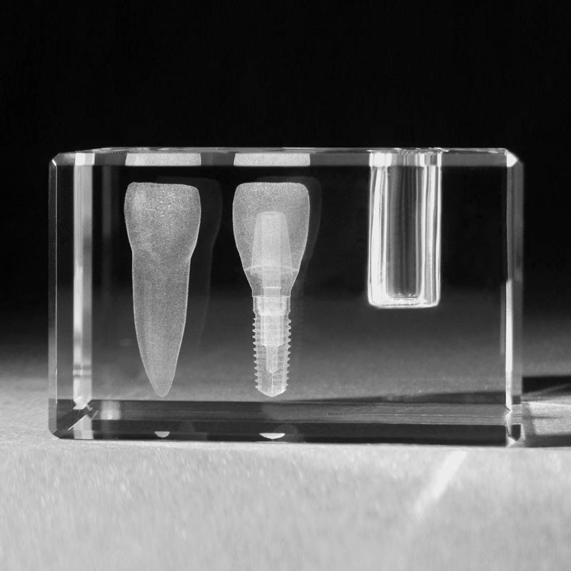 3D Zahnmodell Schneidezahn und Implantat als Zahn Modell Dentalmotive in Glas